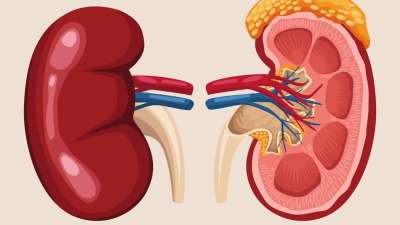 रोगी की दाईं किडनी के स्थान पर निकाली बाईं किडनी
